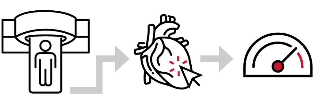 Cardiac Imaging - How it could help you! - Imaging Queensland